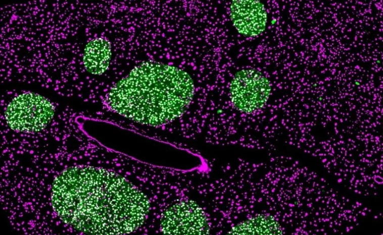 Scientists Develop Way to Manipulate Cell ‘Cleansing’ Process, Opening New Avenues for Cancer, Parkinson’s Research
